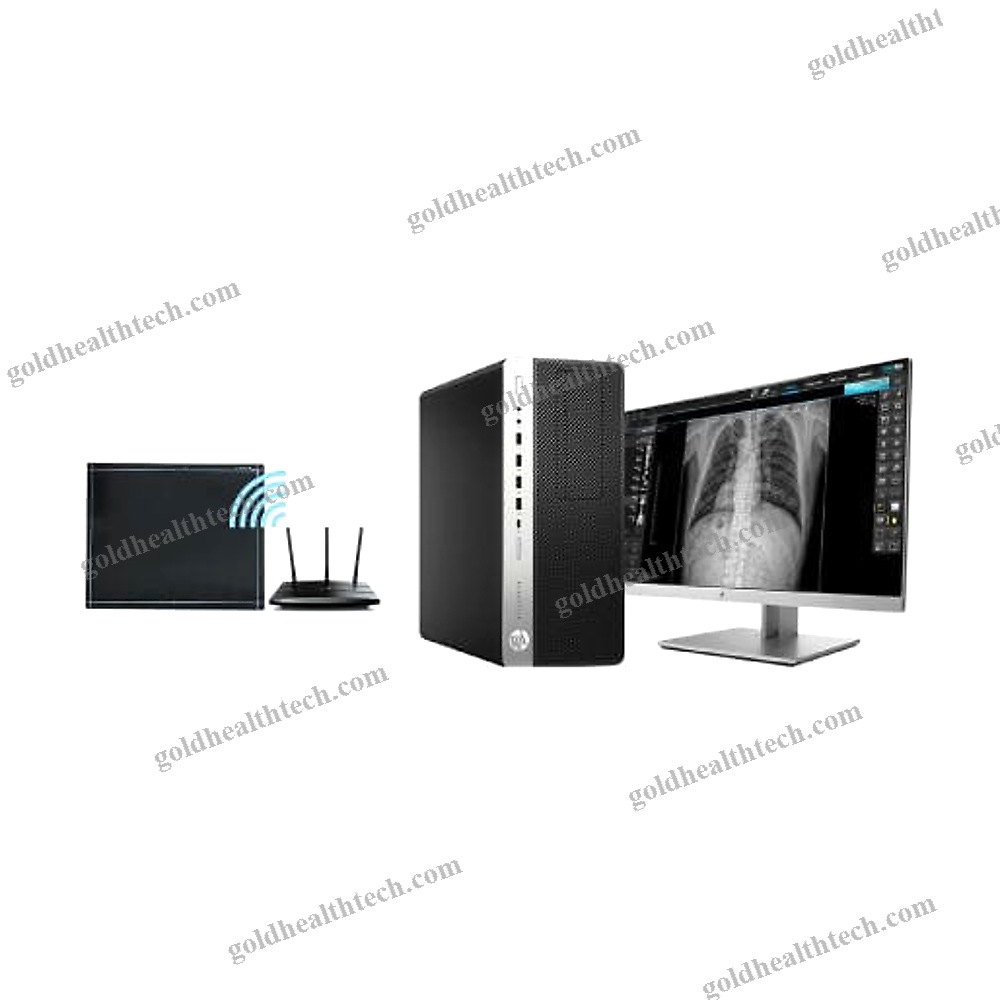 Radiography Acquisition System