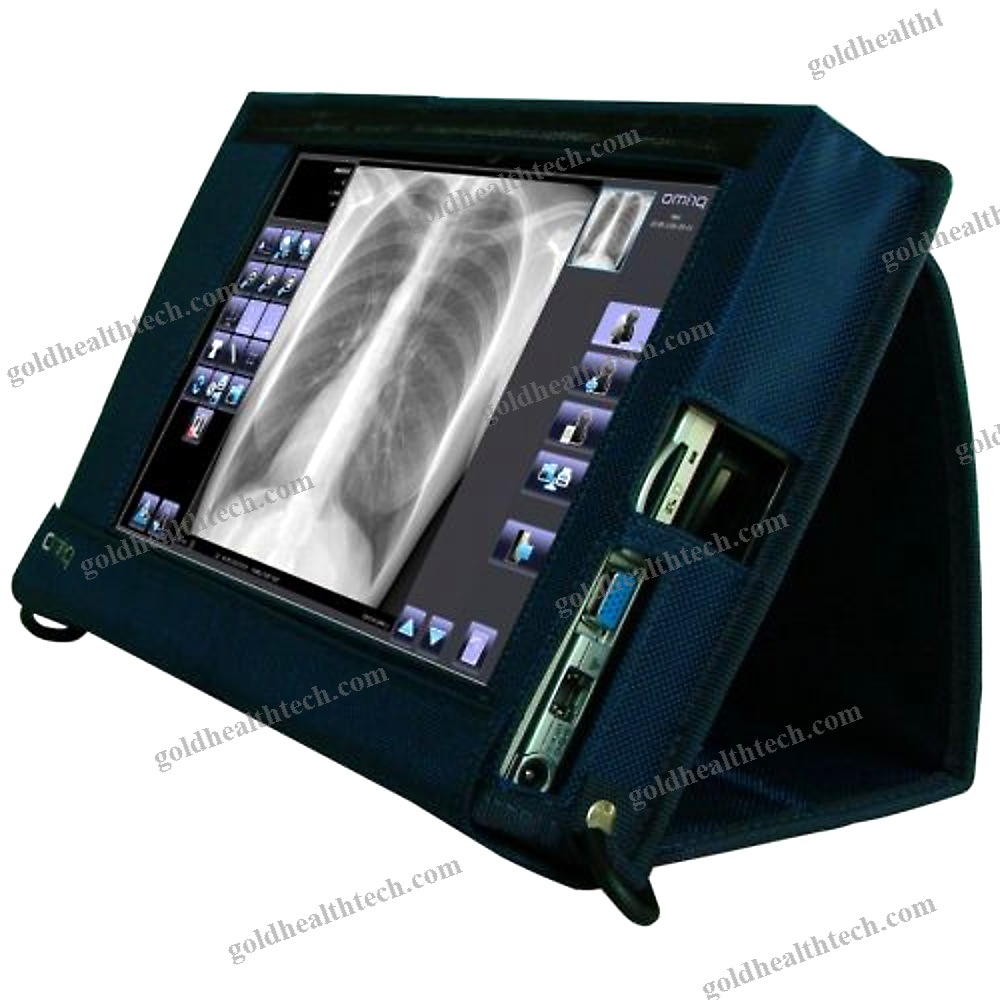 Radiography Acquisition System