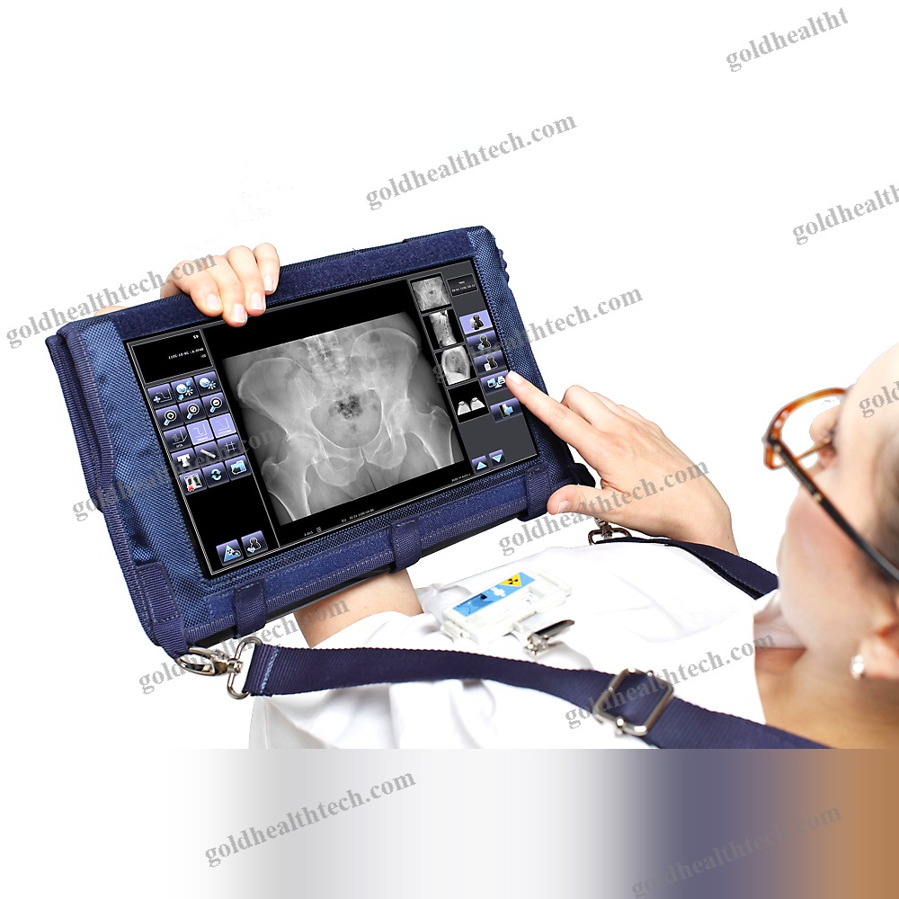 Radiography Acquisition System