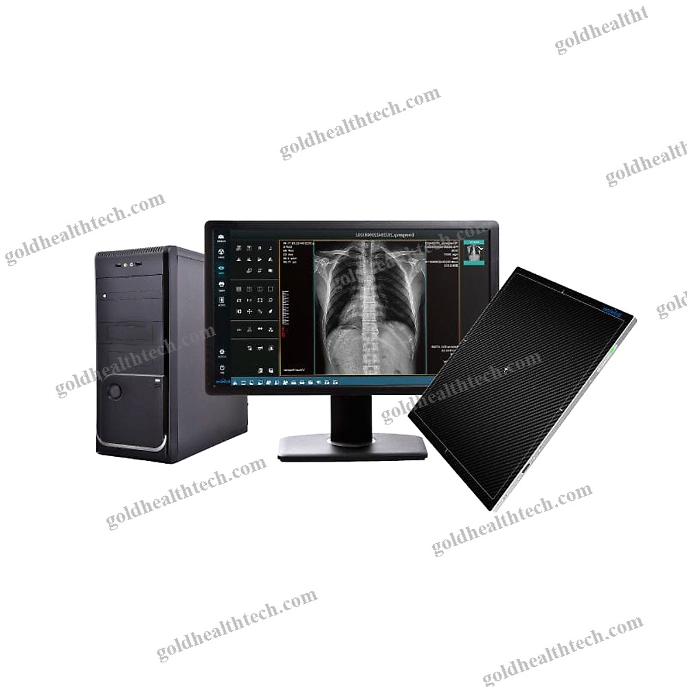Radiography Acquisition System