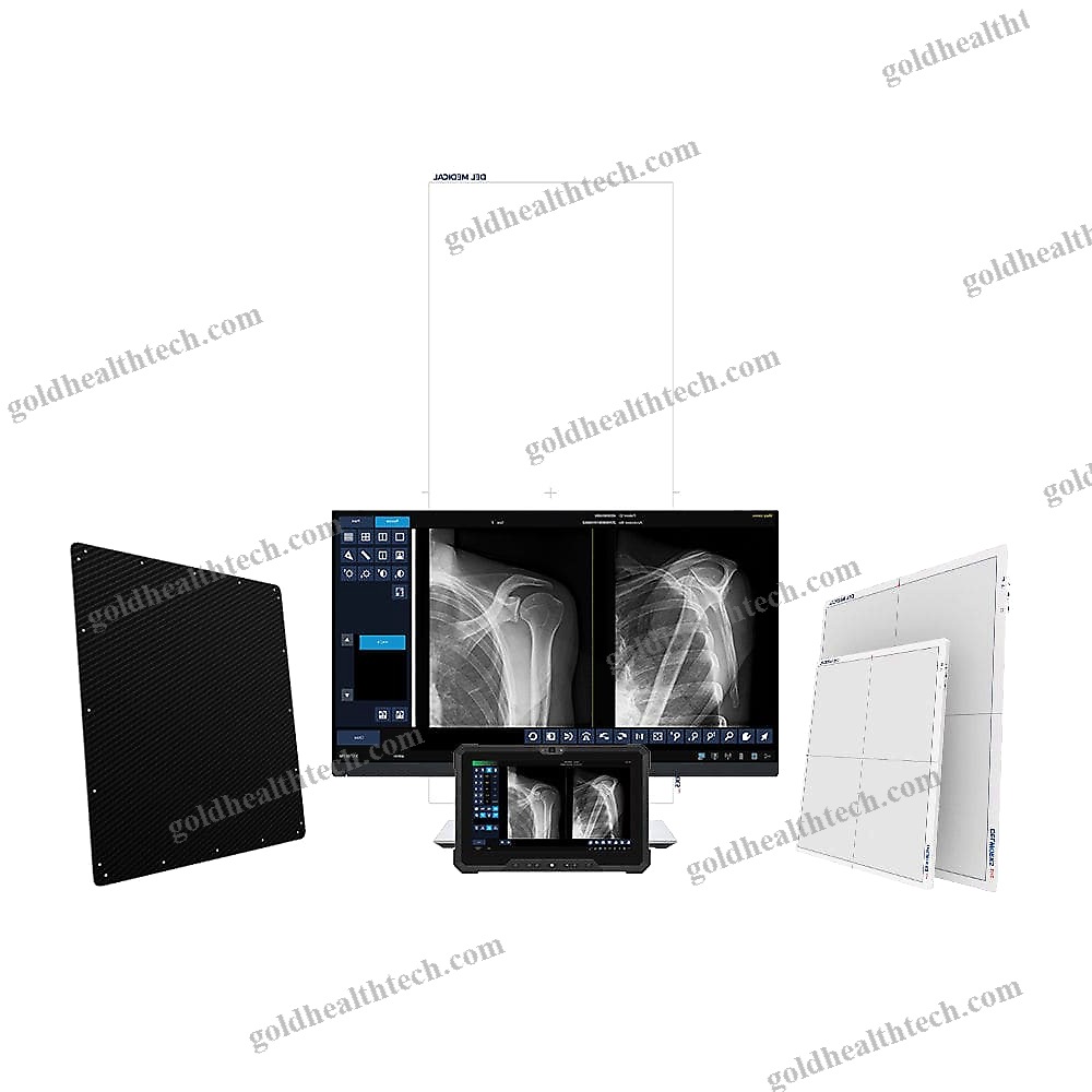 Radiography Acquisition System