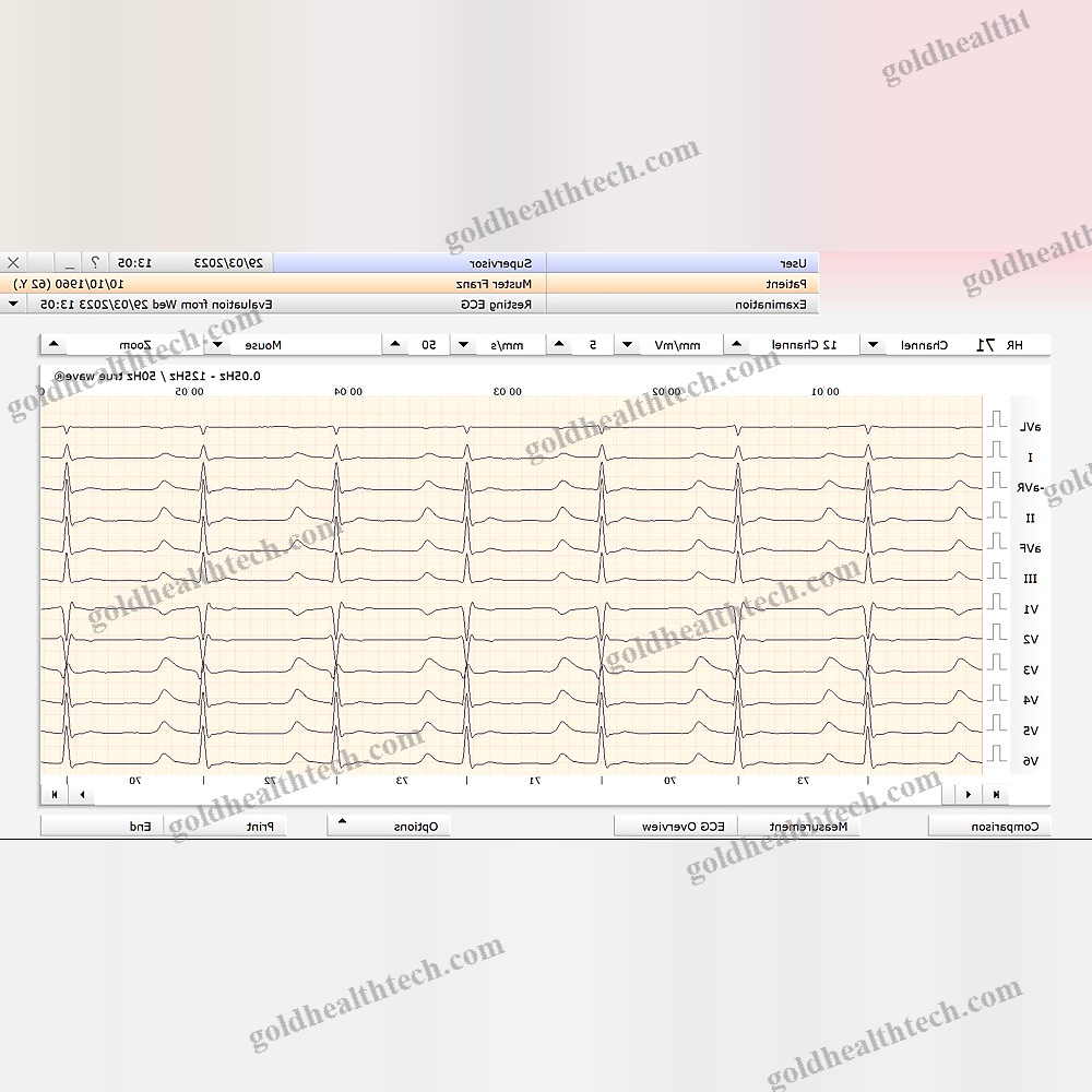 Resting Electrocardiograph 1