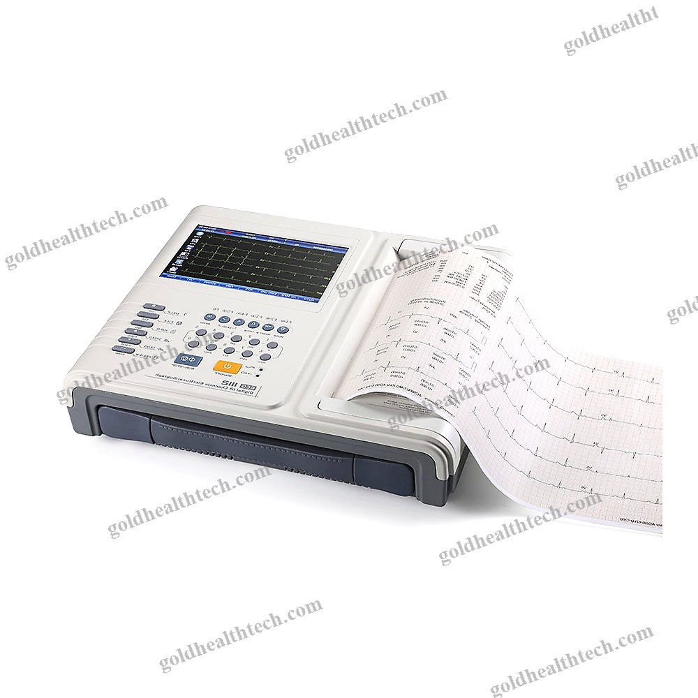 Resting Electrocardiograph 1