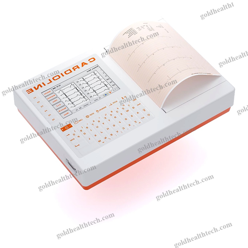 Resting Electrocardiograph 1