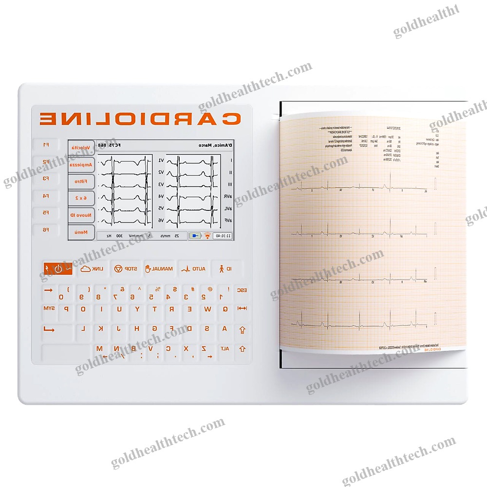 Resting Electrocardiograph