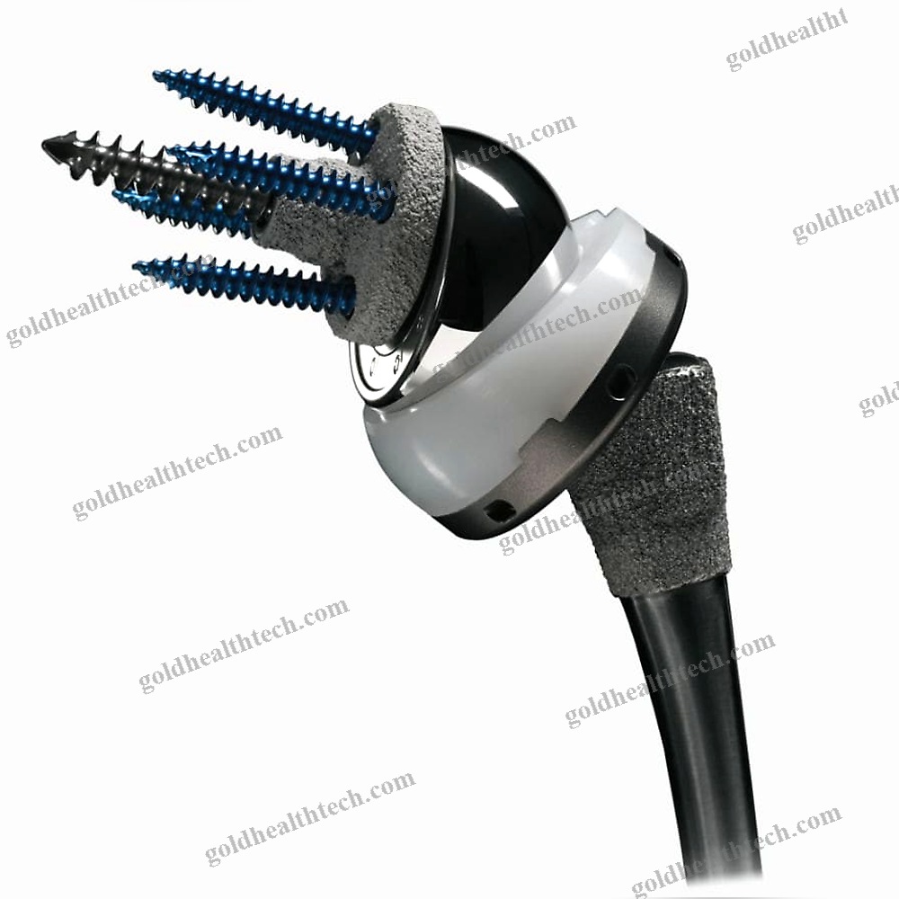 Reverse Shoulder Prosthesis