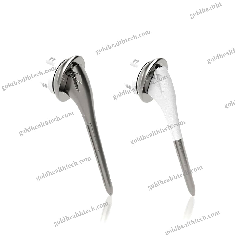 Revision Shoulder Prosthesis