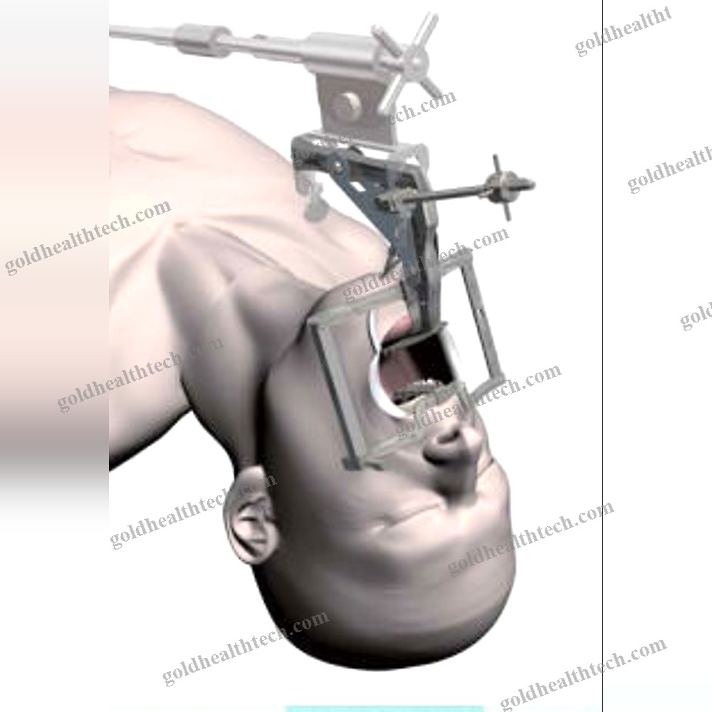 Right-Angle Pharyngoscope