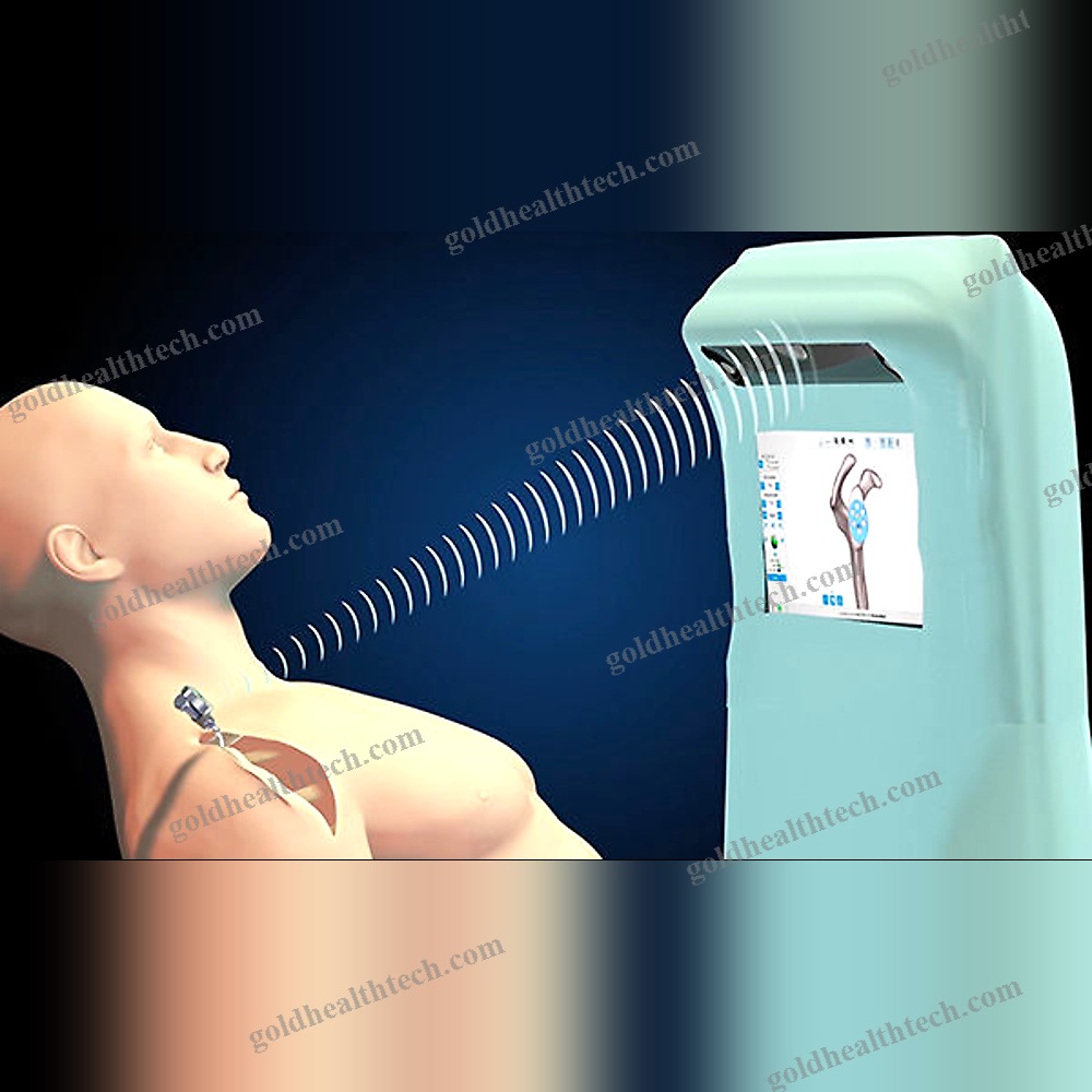 Shoulder Prosthesis Positioning Surgical Navigation System 1