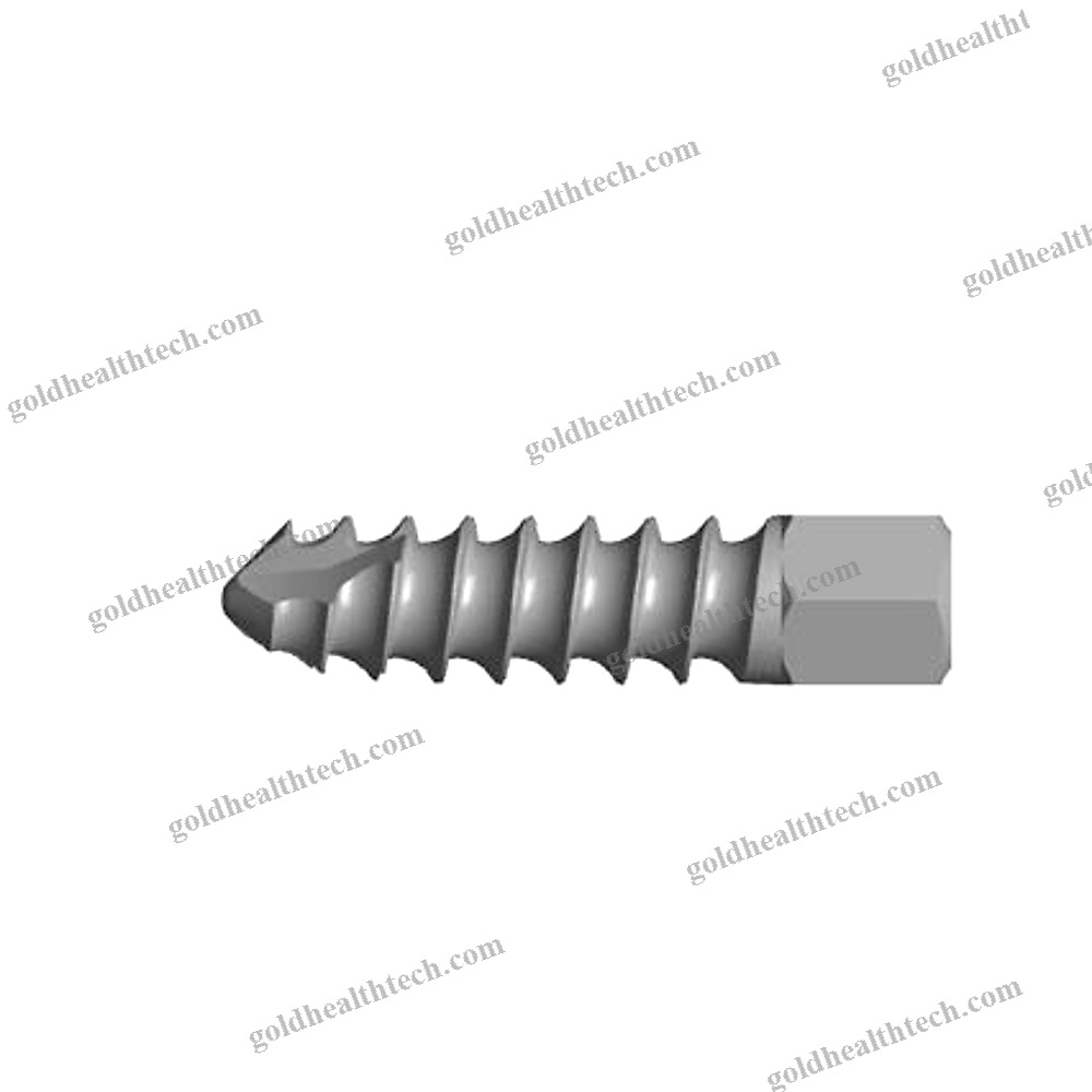 Small Joint Suture Anchor