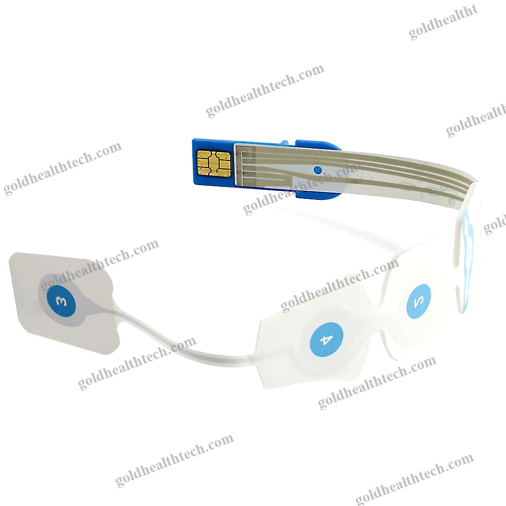 Stimulation Electrode 1