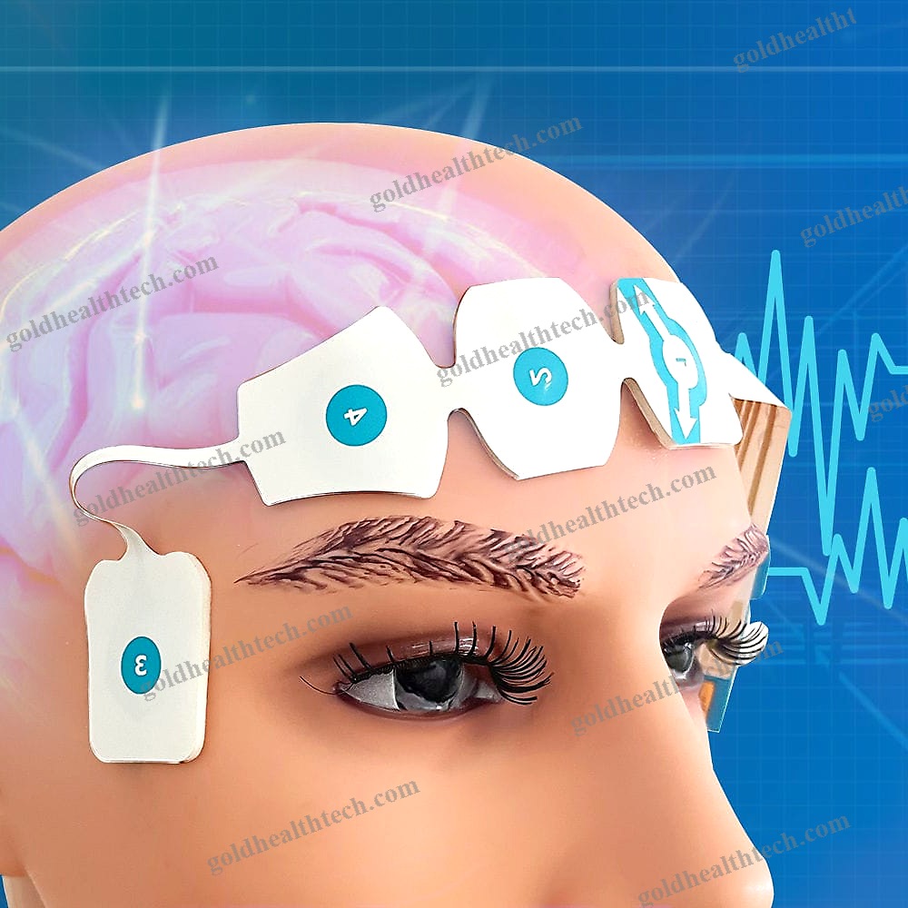 Stimulation Electrode