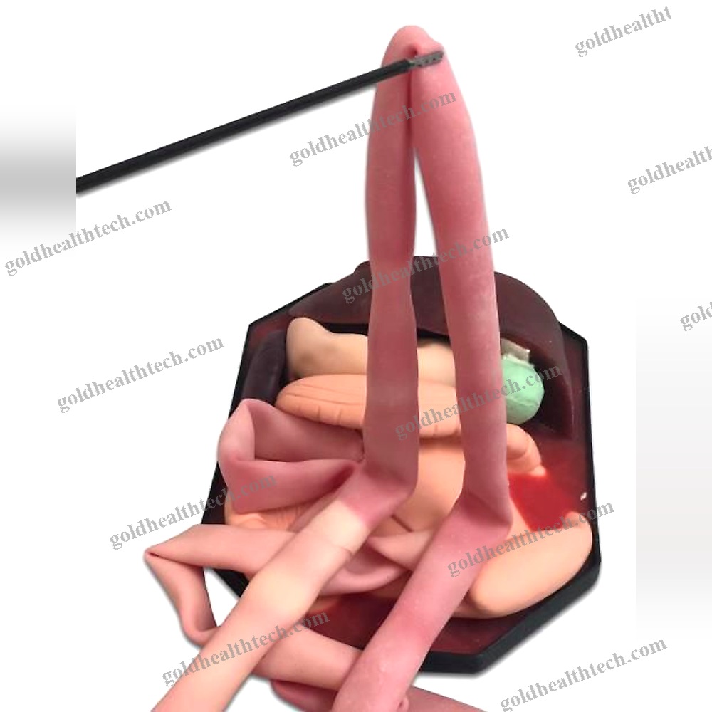 Stomach Model