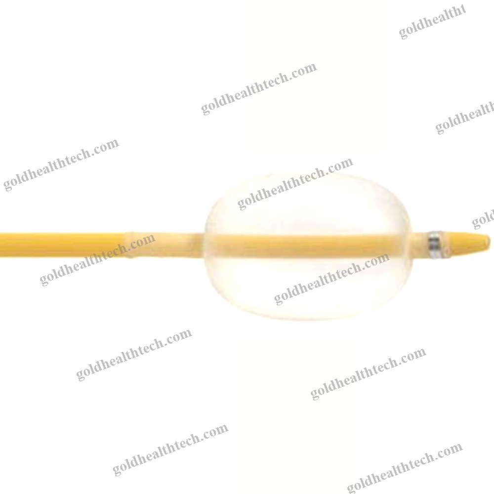 Stone Extraction Catheter 1