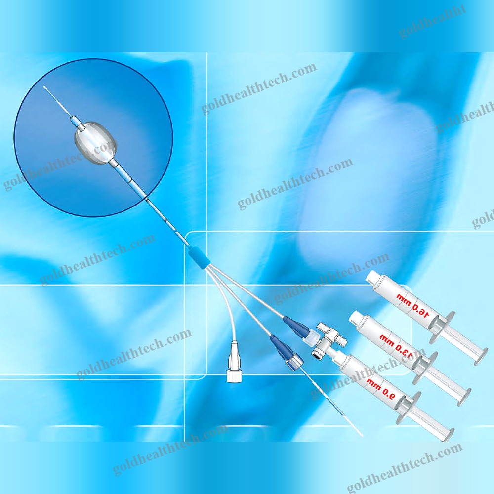 Stone Extraction Catheter
