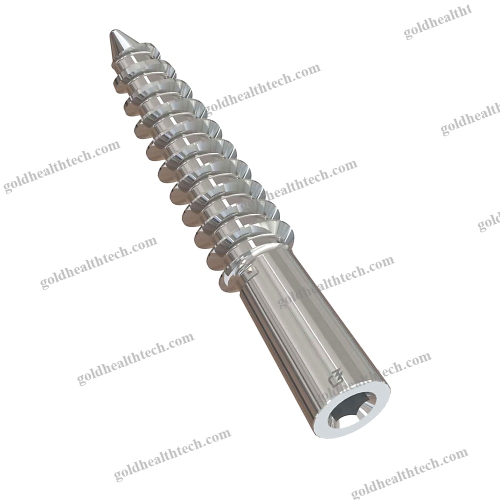 Subtalar Joint Arthrodesis Screw