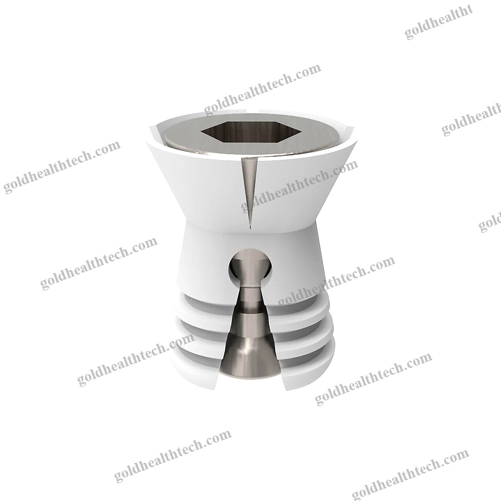 Subtalar Joint Implant