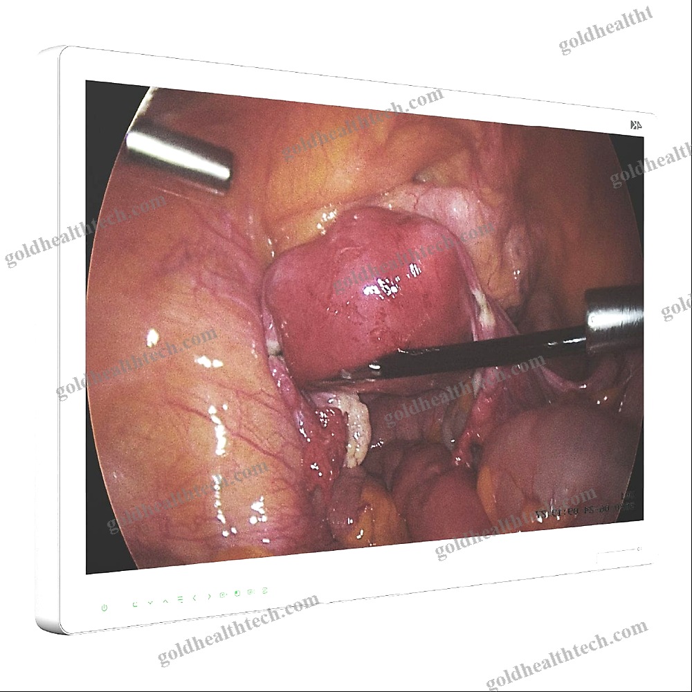 Surgical Display