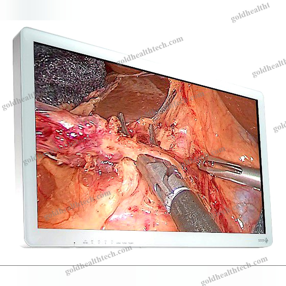 Surgical Display