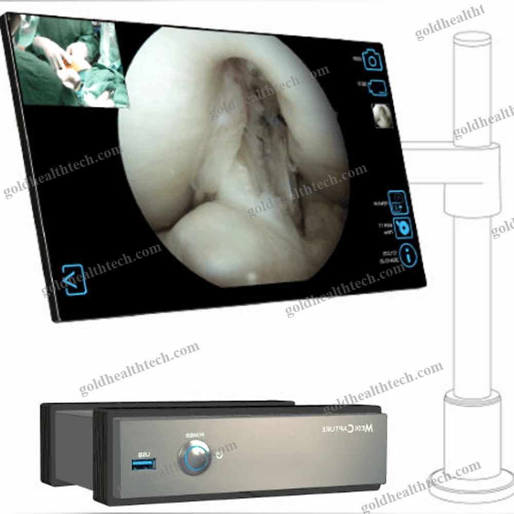 Surgical Video Recorder