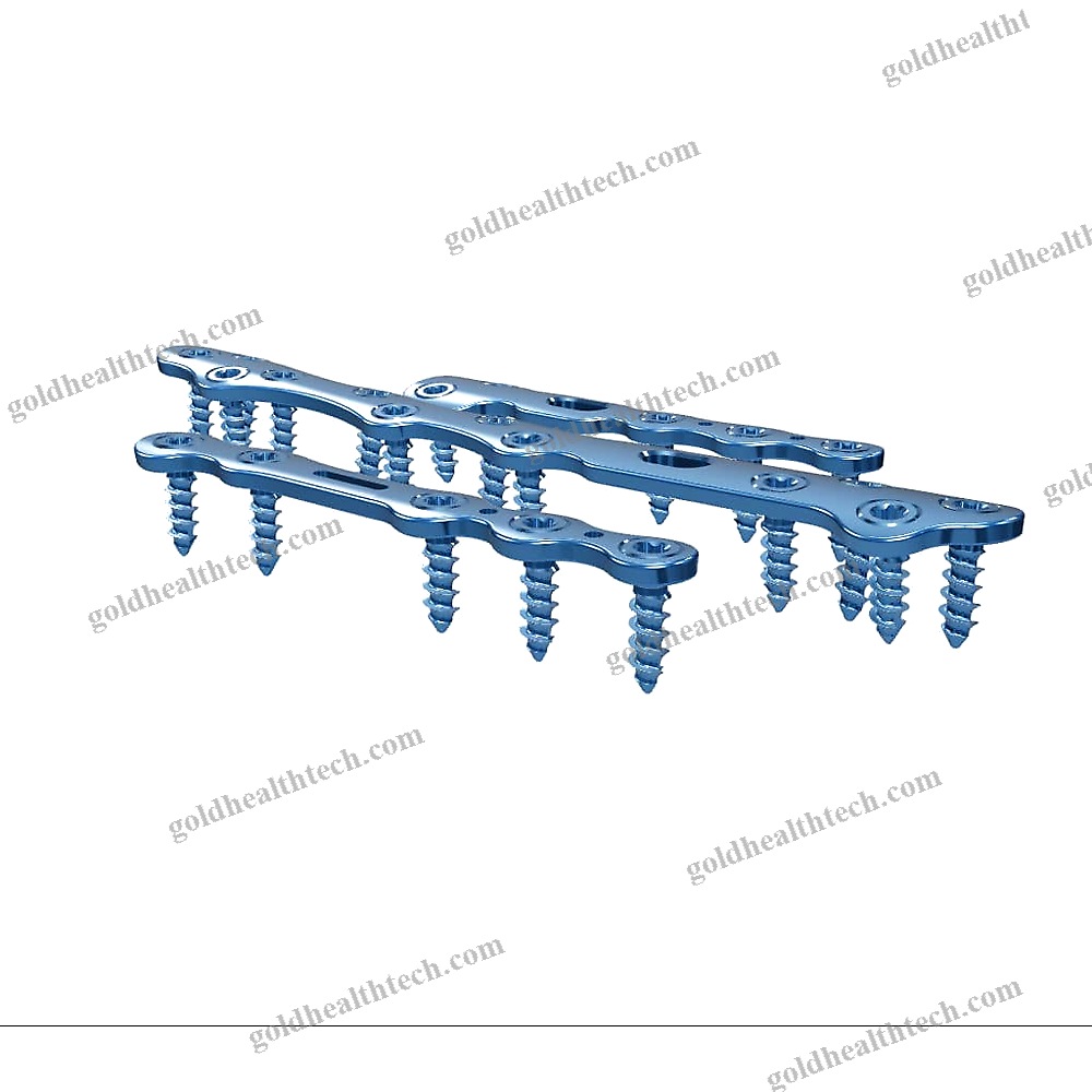 Tarso-Metatarsal Joint Arthrodesis Plate