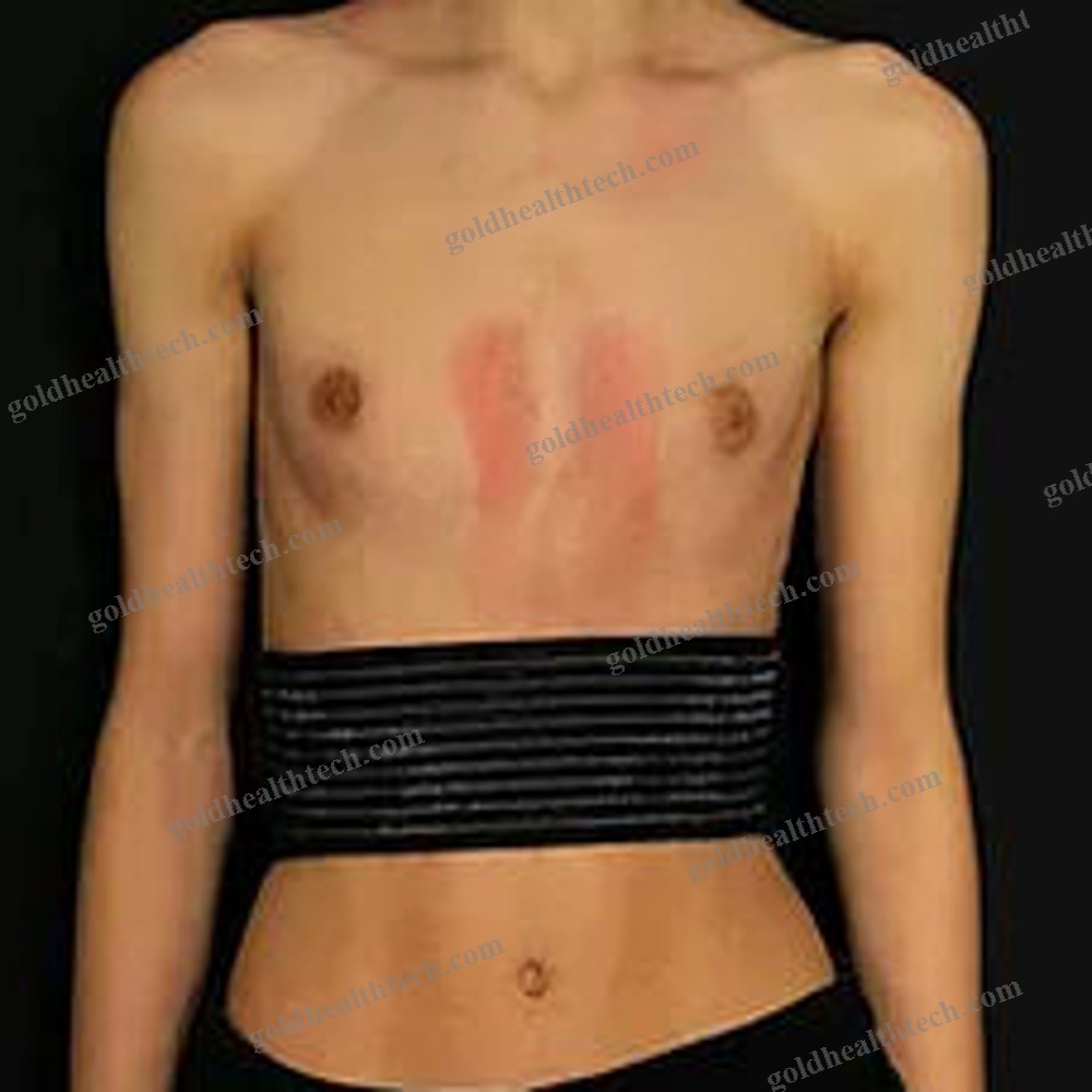 Thoracic Support Belt 1