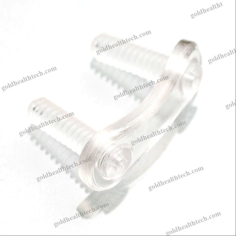 Thoraco-Lumbar Arthrodesis Plate