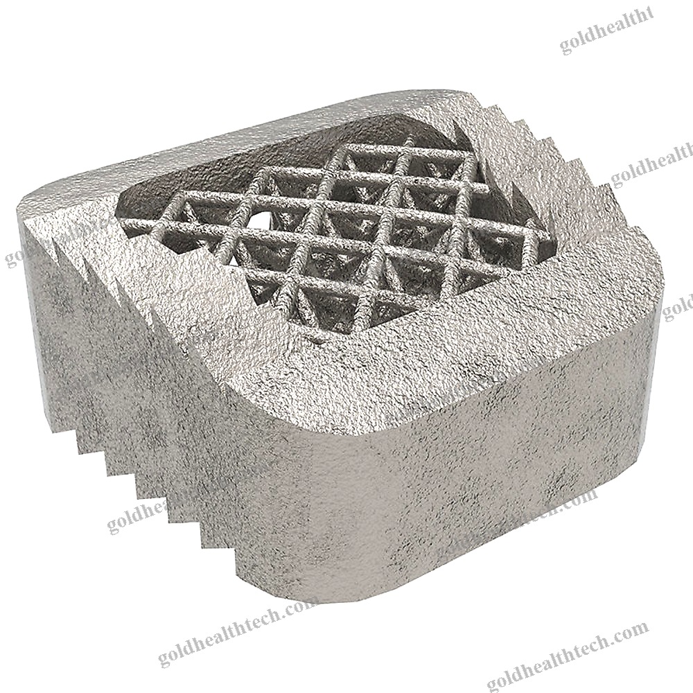 Thoraco-Lumbar Interbody Fusion Cage