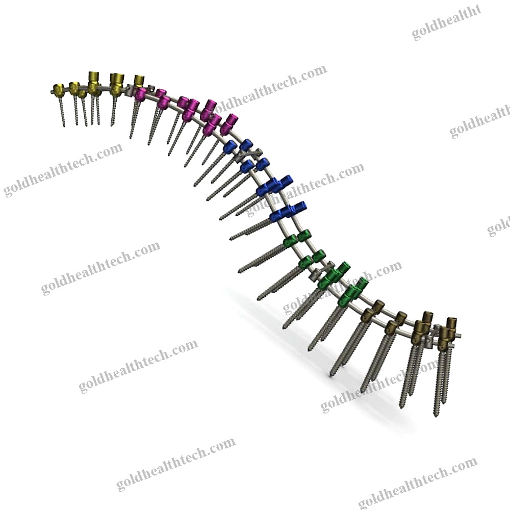 Thoraco-Lumbar Osteosynthesis Unit