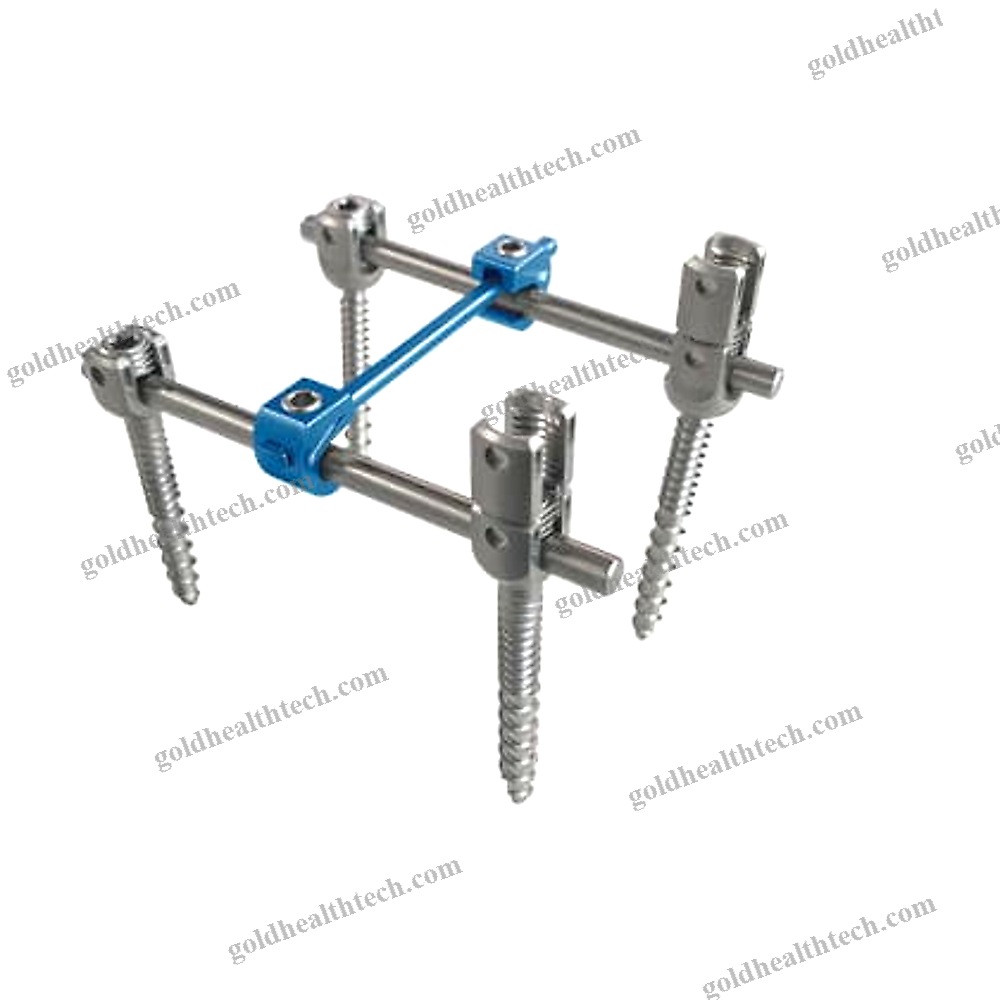 Thoraco-Lumbar Osteosynthesis Unit