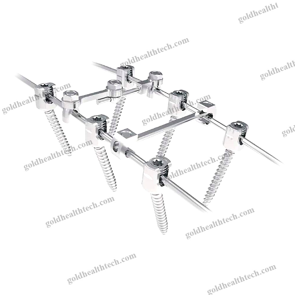Thoraco-Lumbar Osteosynthesis Unit