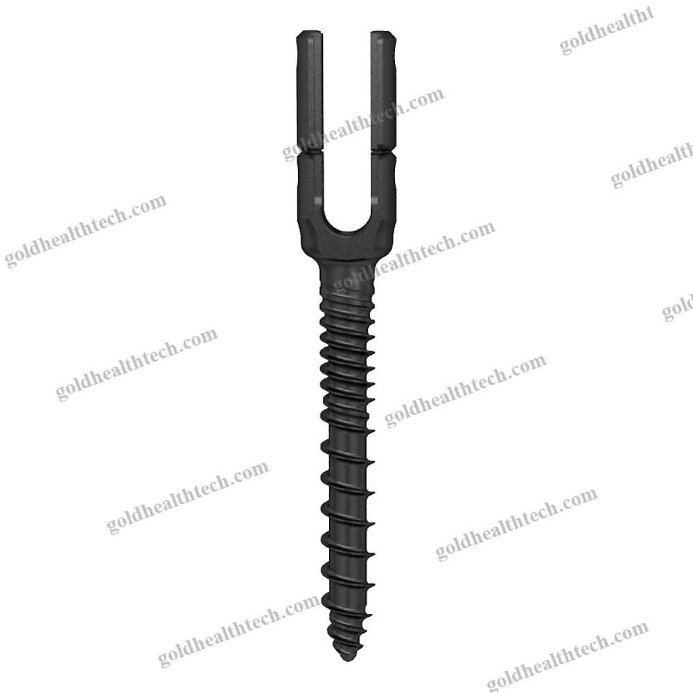 Thoraco-Lumbar Pedicle Screw