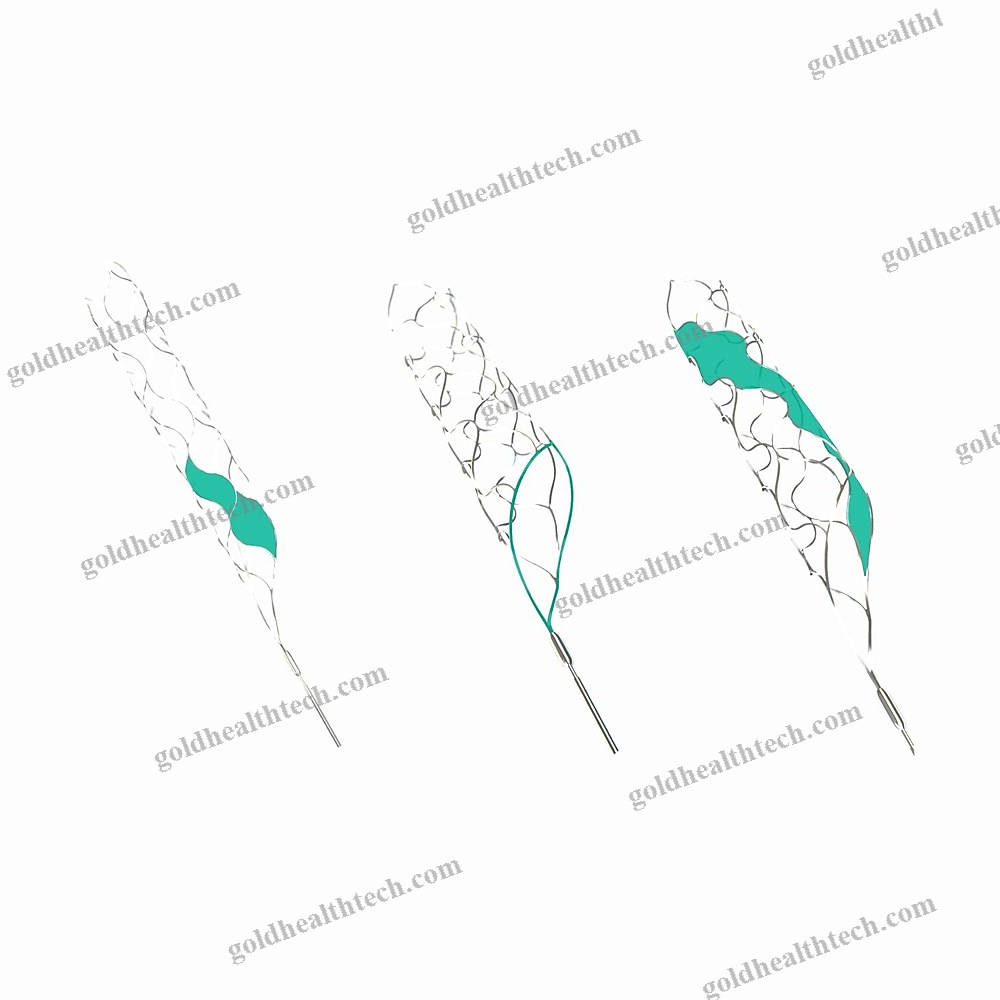 Thrombectomy Catheter