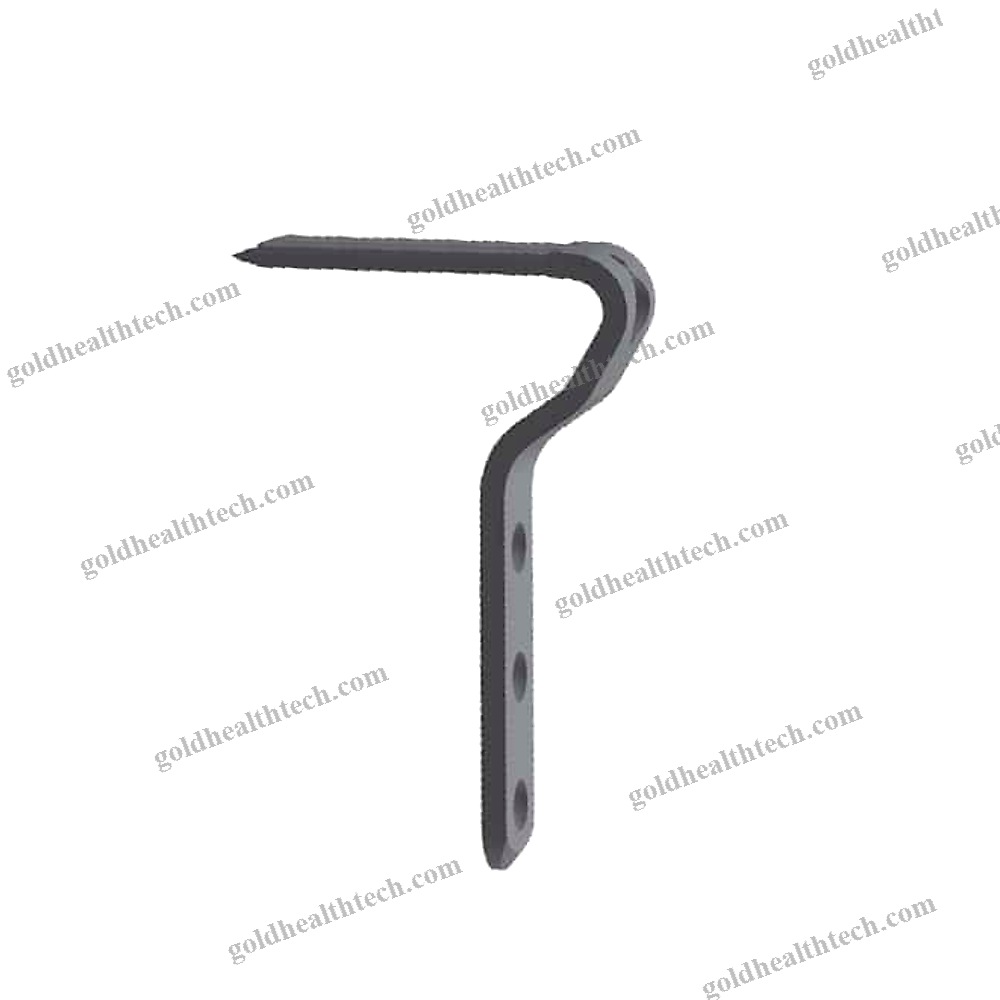 Tibia Osteotomy Plate