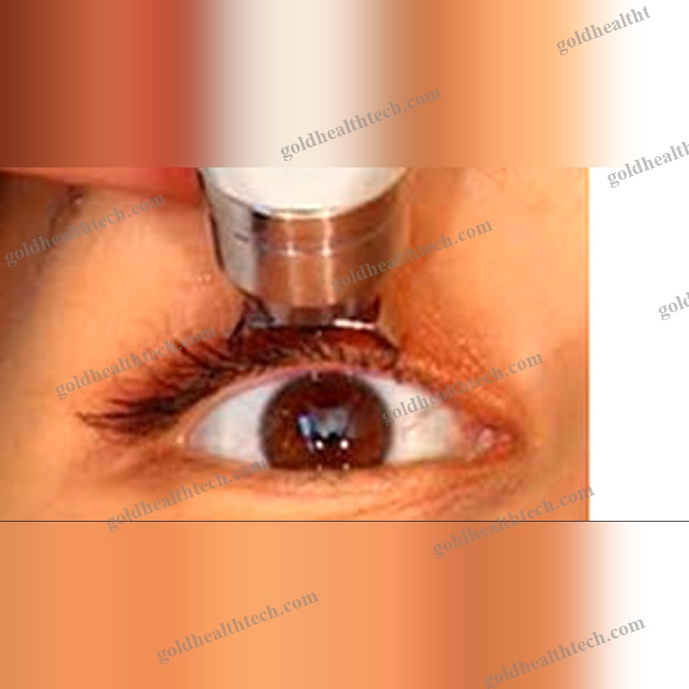 Tonometer 1