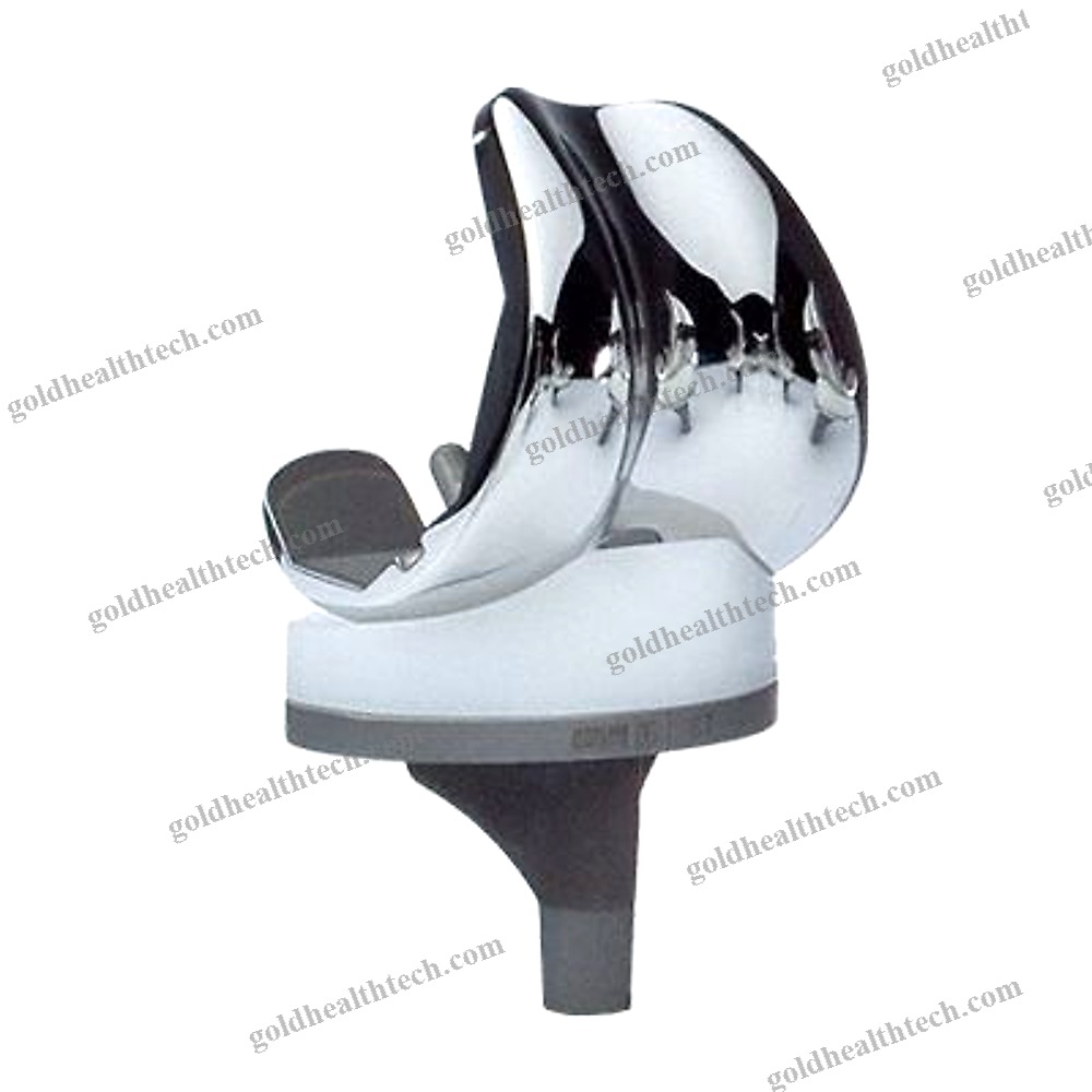 Total Knee Prosthesis 1