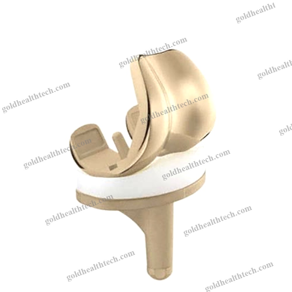 Total Knee Prosthesis