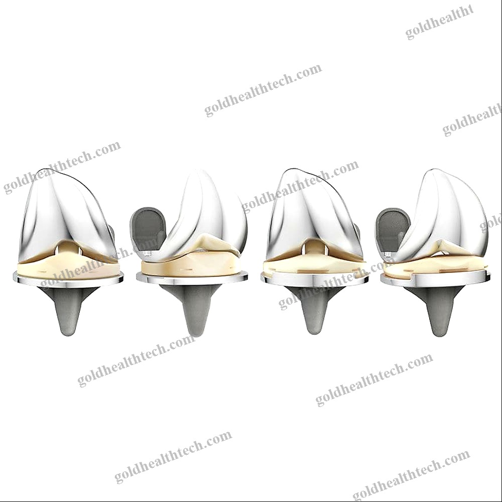 Total Knee Prosthesis