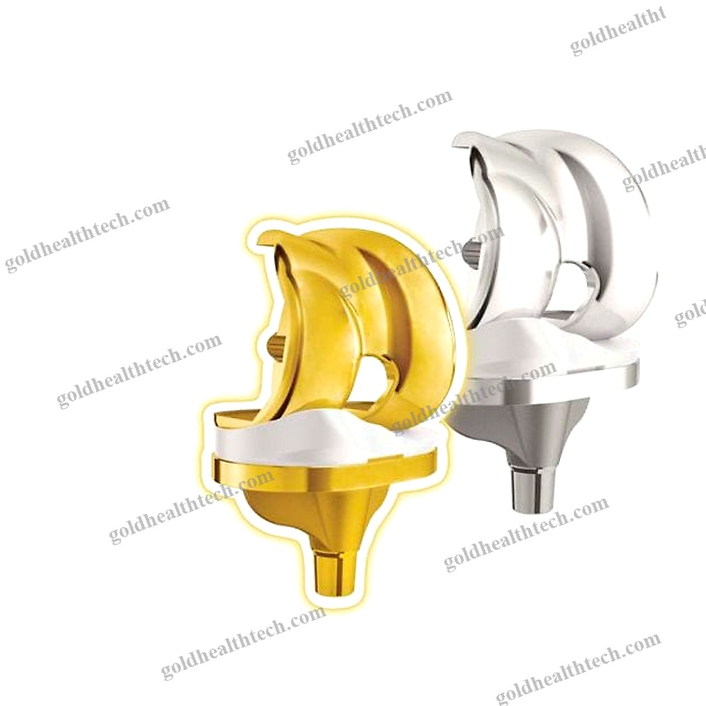 Total Knee Prosthesis