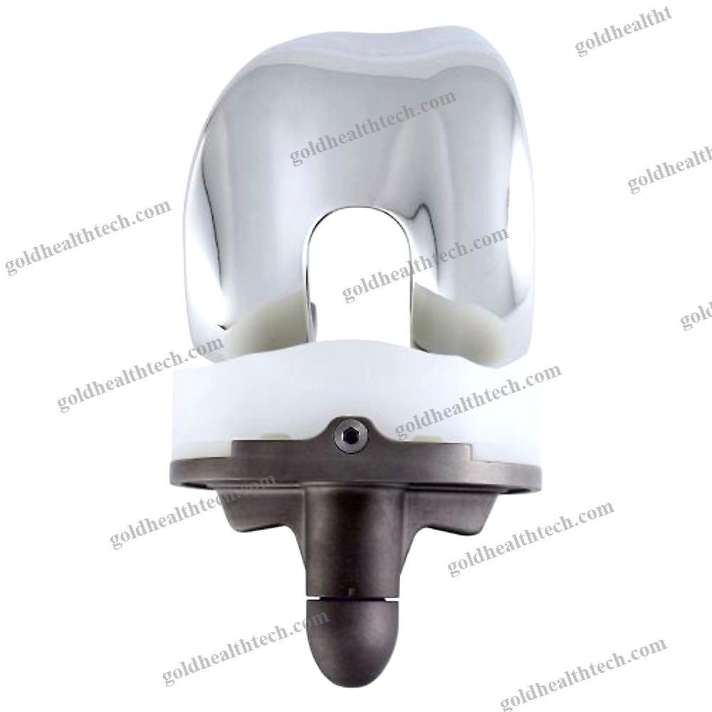 Total Knee Prosthesis