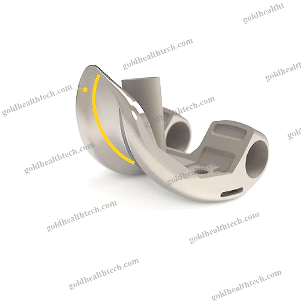 Total Knee Prosthesis 1