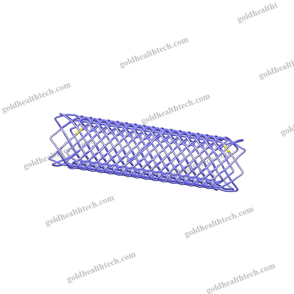 Tracheal Stent