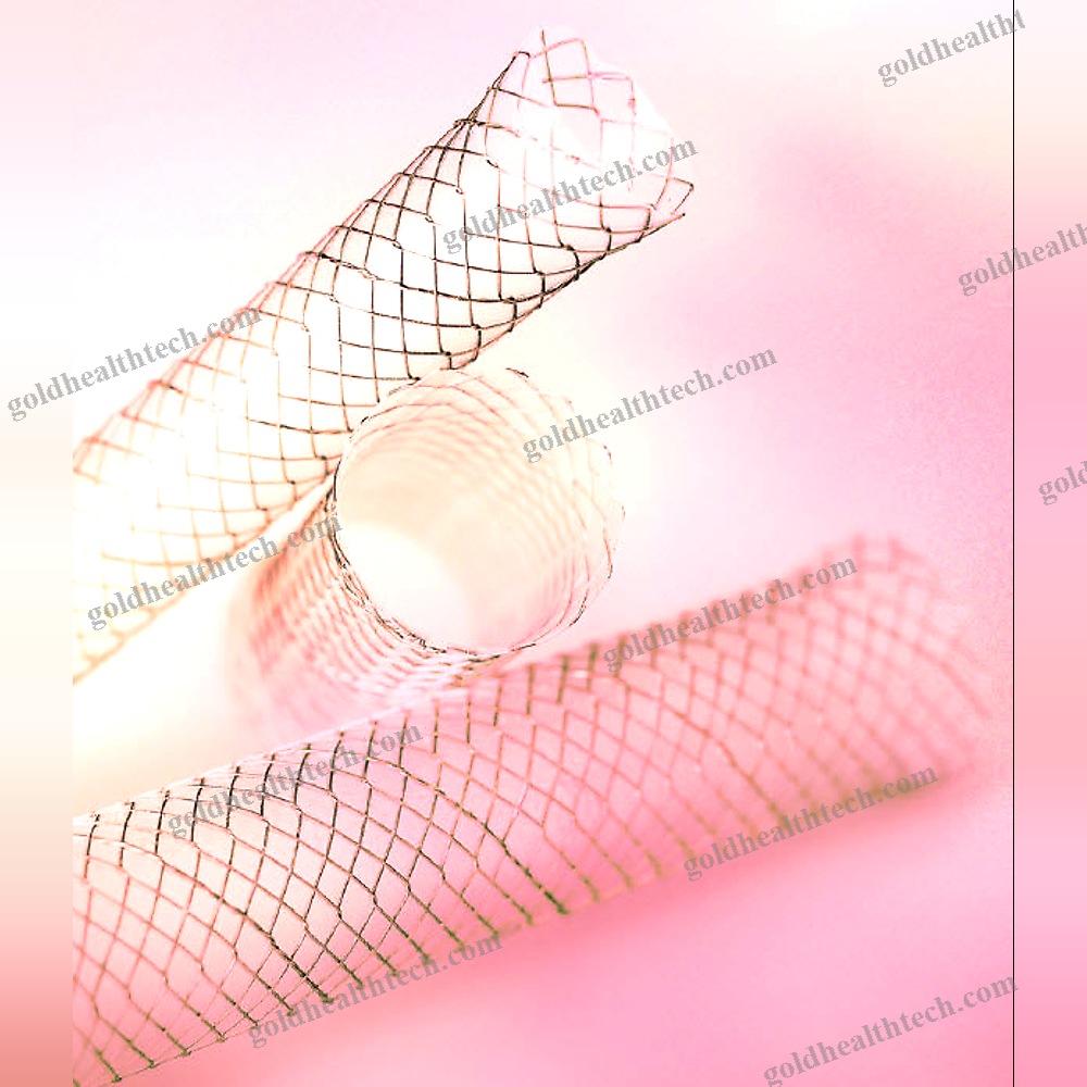 Tracheal Stent