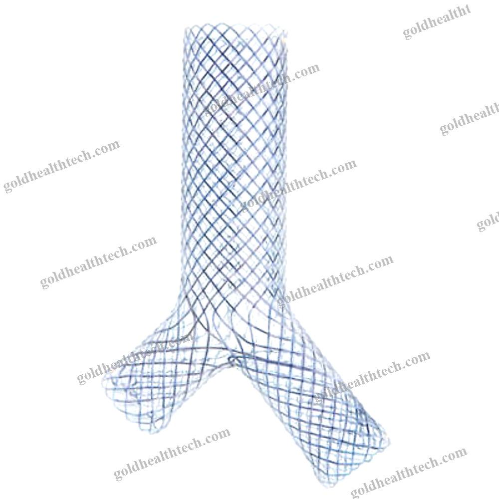 Tracheal Stent