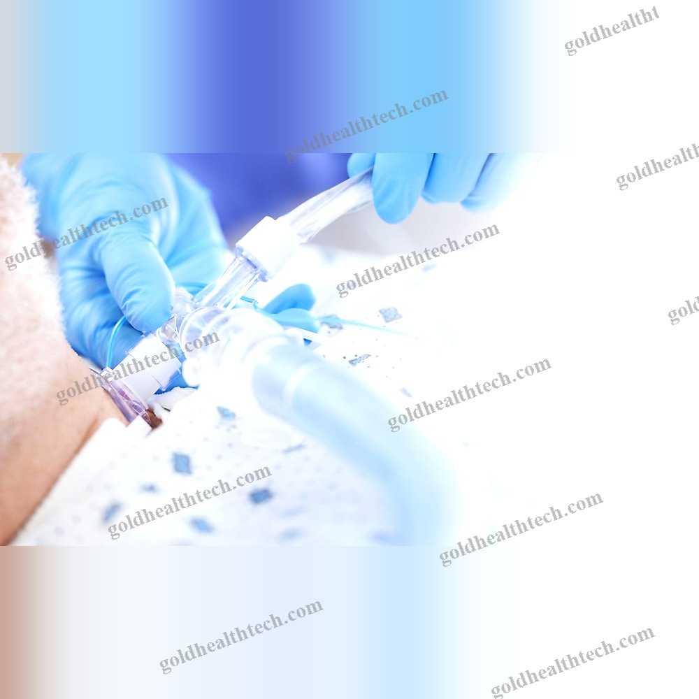 Tracheotomy Cannula 1