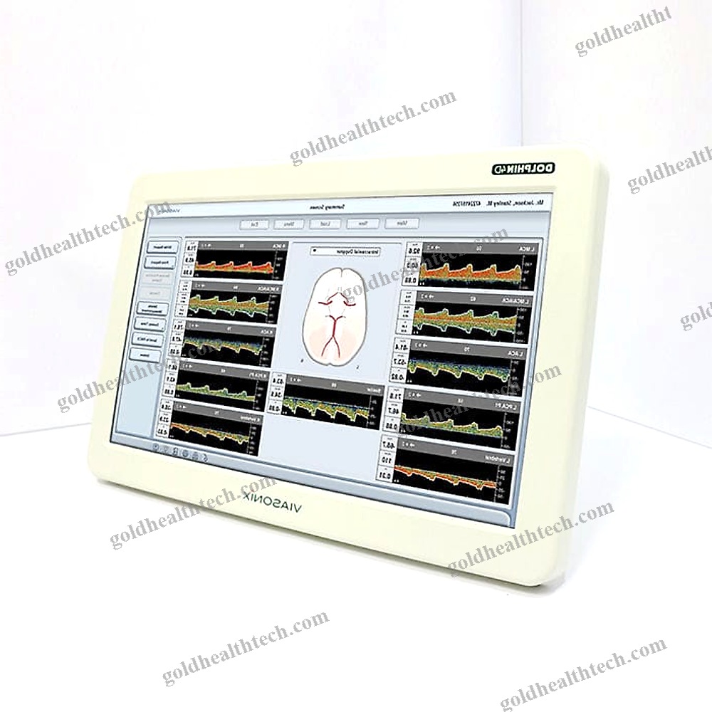 Transcranial Doppler