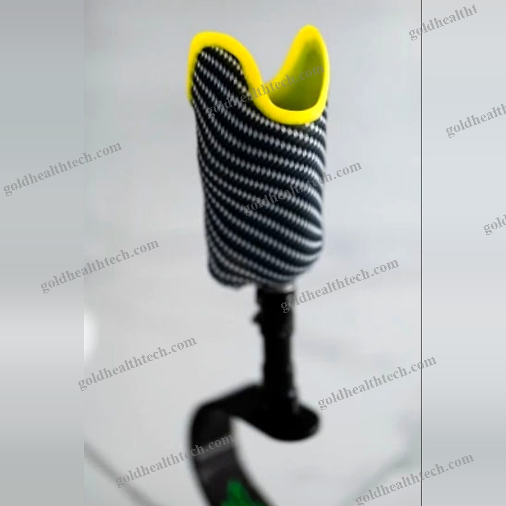 Transtibial Prosthetic Socket