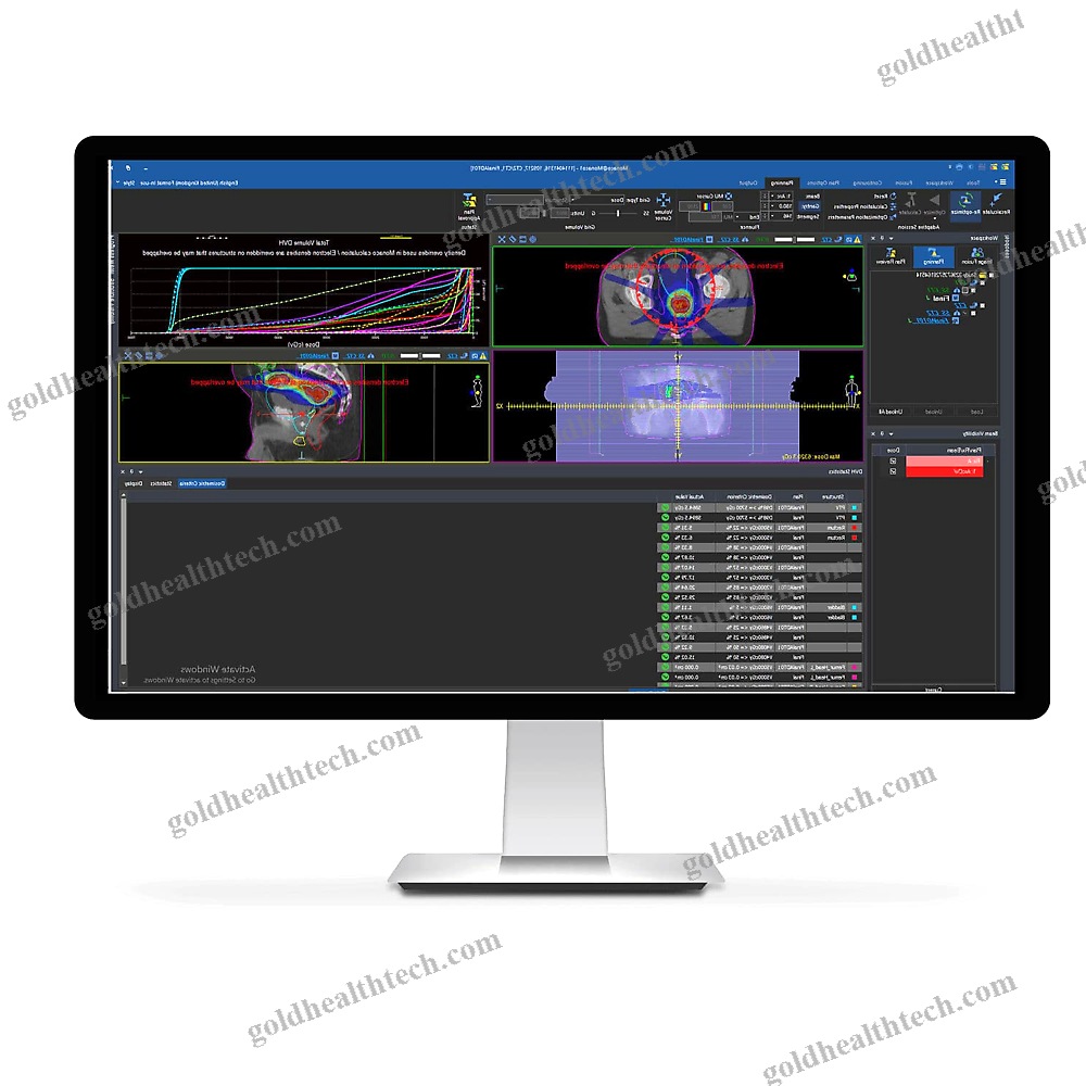 Treatment Planning Software