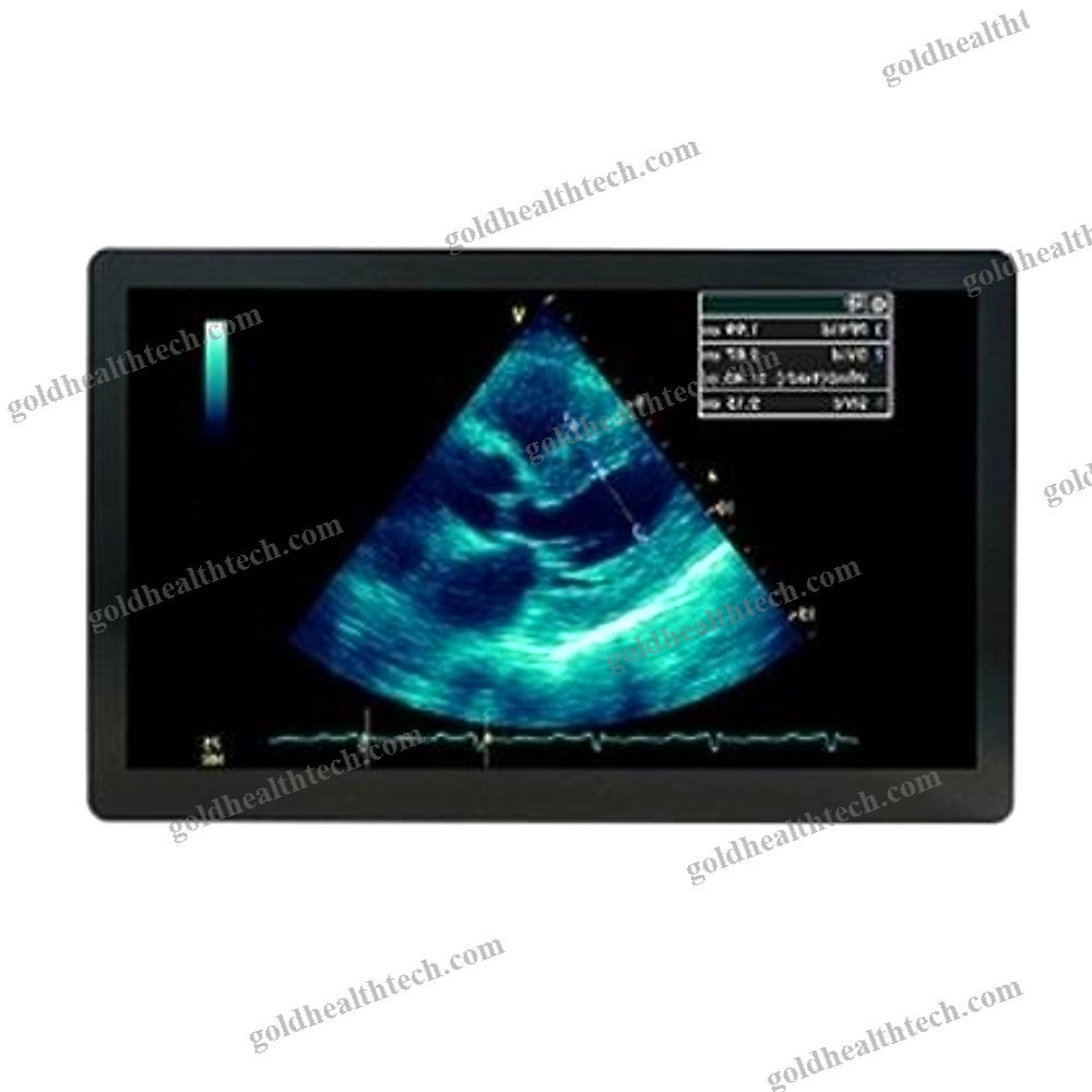 Ultrasound Imaging Display