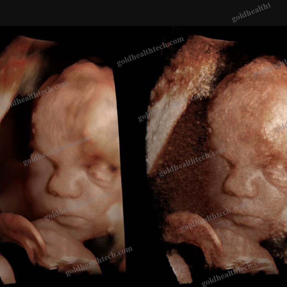 Ultrasound Imaging Software